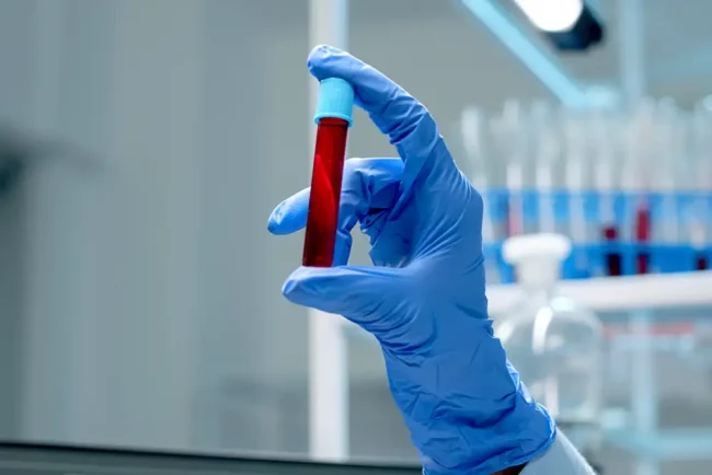 Investing in BloodFluid WarmersKey Benefits for Hospitals and Clinics